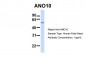 TMEM16K antibody - C-terminal region